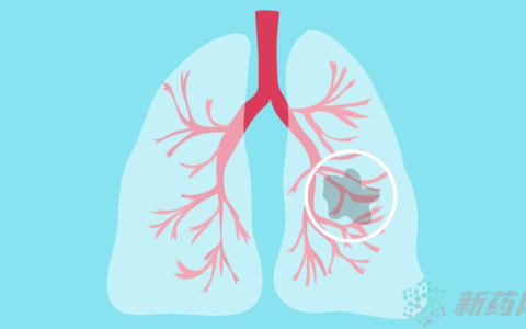 肺癌患者为什么要做基因检测？这篇文章告诉你答案！